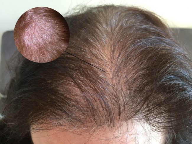 Thay vì tốn thật nhiều tiền cho những sản phẩm chăm sóc và điều trị tóc hư tổn, những thảo dược và món ăn dưới đây sẽ giúp chúng ta có được mái tóc dày mượt mà.