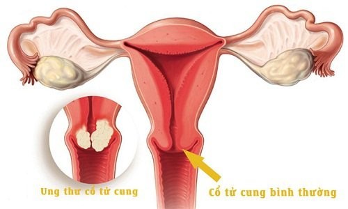 1. Chảy máu bất thường
