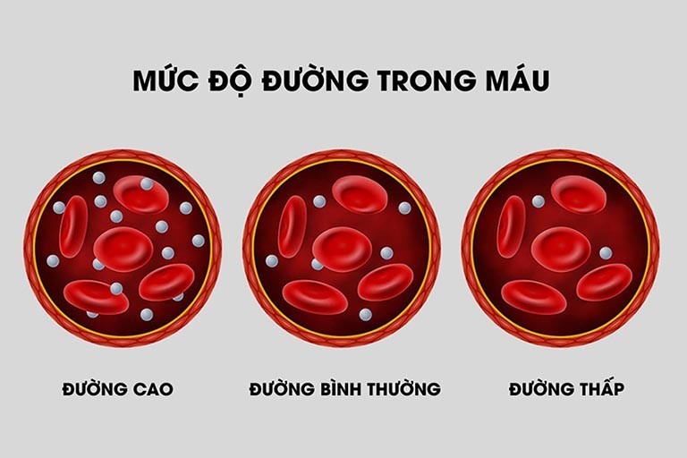 Đường huyết là gì? Tăng giảm đường huyết có nguy hiểm không?