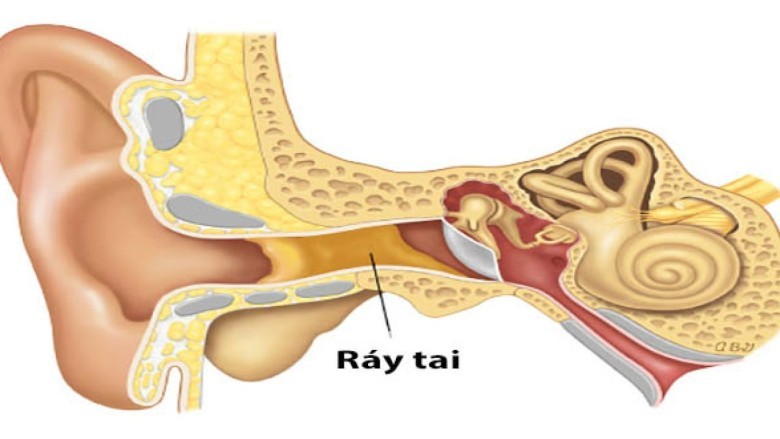 Sự thực về việc lấy ráy tai