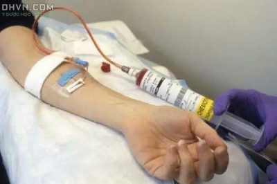 Người đang Hóa trị, xạ trị bệnh Ung Thư thì có nên uống thêm thuốc đông y?