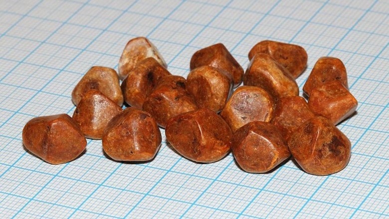 Bệnh Sỏi mật là gì, điều trị Sỏi mật thế nào hiệu quả