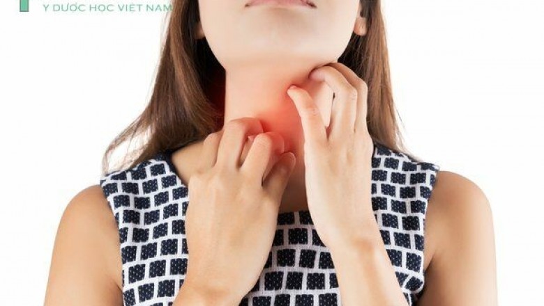 8 loại cây cỏ trong vườn nhà trị viêm họng: theo Lương y Nguyễn Văn Quyết