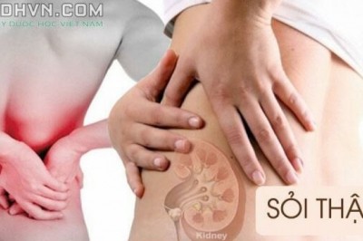 Bệnh sỏi thận, các loại sỏi thận, Nguyên nhân, Triệu chứng, điều trị, phòng bệnh