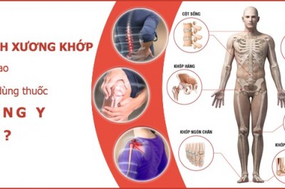 Cách chữa đau nhức xương khớp tại nhà đơn giản, hiệu quả từ cây thuốc, Bài thuốc quen thuộc