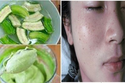 Hướng dẫn Trị Nám da, trị mụn trứng cá, giảm cân bằng quả chuối xanh cực tốt