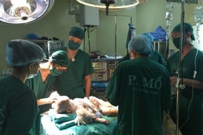 Tổ chức chương trình khám và phẫu thuật dị tật cơ xương khớp trẻ em