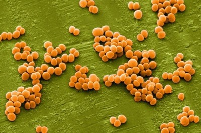 Vi khuẩn tụ cầu vàng nguy hiểm như thế 