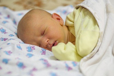 Trẻ sơ sinh bị vàng da, cẩn trọng với teo đường mật bẩm sinh