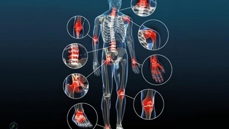 Thoái hóa khớp là gì? Nguyên nhân, triệu chứng và cách chữa tốt nhất