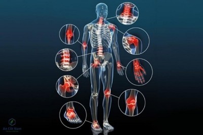Thoái hóa khớp là gì? Nguyên nhân, triệu chứng và cách chữa tốt nhất
