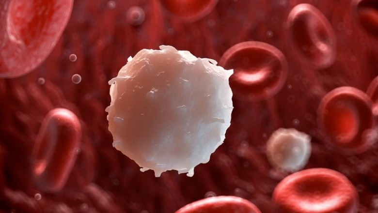 Bệnh bạch cầu cấp là gì?