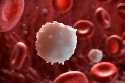 Bệnh bạch cầu cấp là gì?