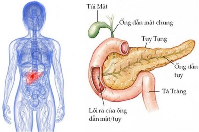 Ung thư tuyến tụy, ung thư tụy