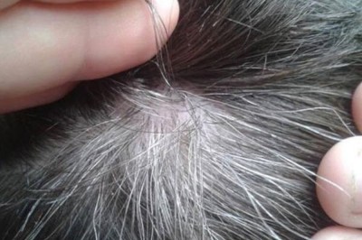 Món ăn bài thuốc chống bạc tóc, rụng tóc cực kỳ hiệu quả