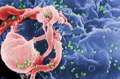 Thêm bệnh nhân thứ 3 chữa khỏi HIV