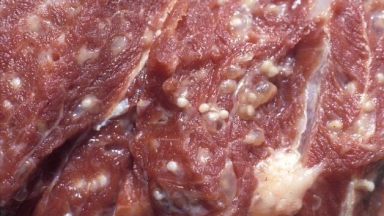 Ăn thịt lợn đầy hạch trắng, hơn 400 học sinh phải đi xét nghiệm bệnh nguy hiểm