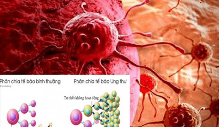 Những bí ẩn ít biết về Tế bào ung thư