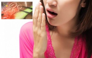 Bài thuốc đông y trị bệnh hôi miệng, bệnh thối mồm, hơi thở thối