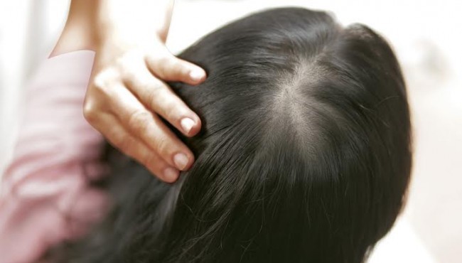 Tóc rụng nhiều phải làm sao để chấm dứt?