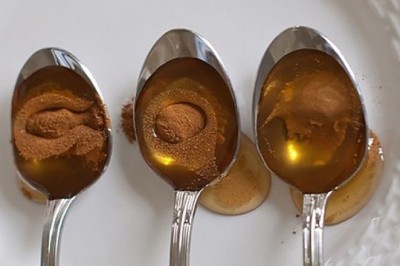 Hỗn hợp mật ong, quế trị nhiều bệnh