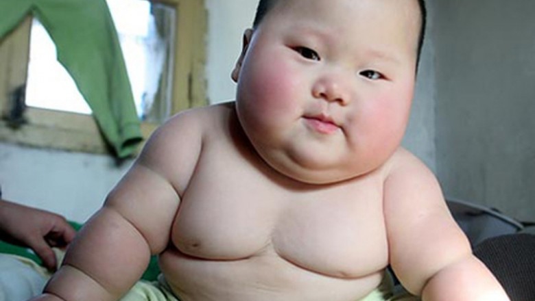 Quan niệm và điều trị béo phì theo y học cổ truyền