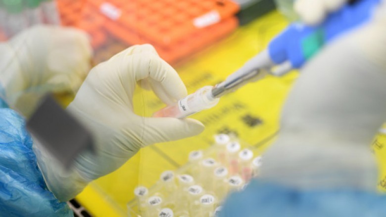Công ty Mỹ tuyên bố chế tạo thành công vắcxin chống virus corona