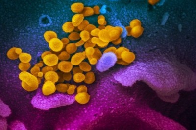 Que thử xét nghiệm nCoV trong 20 phút