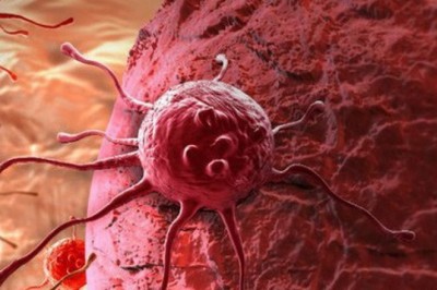 Tác dụng không mong muốn của các phương pháp điều trị toàn thân ung thư phổi