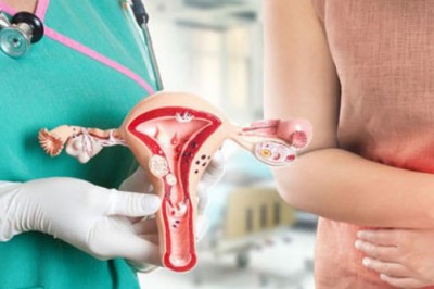 8 hiểu lầm về ung thư cổ tử cung