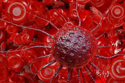 Những bệnh ung thư thường gặp nhất