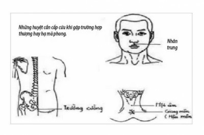 Thượng mã phong - Trạng thái nguy hiểm khi 'yêu'