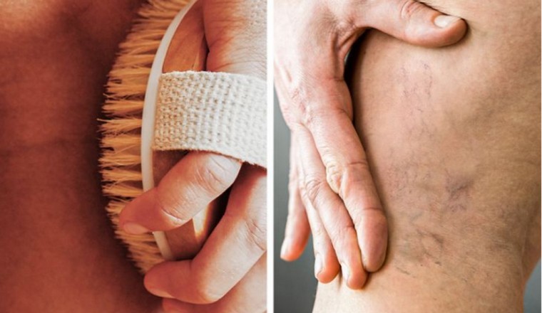 Những thói quen hằng ngày gây tổn thương cho tĩnh mạch