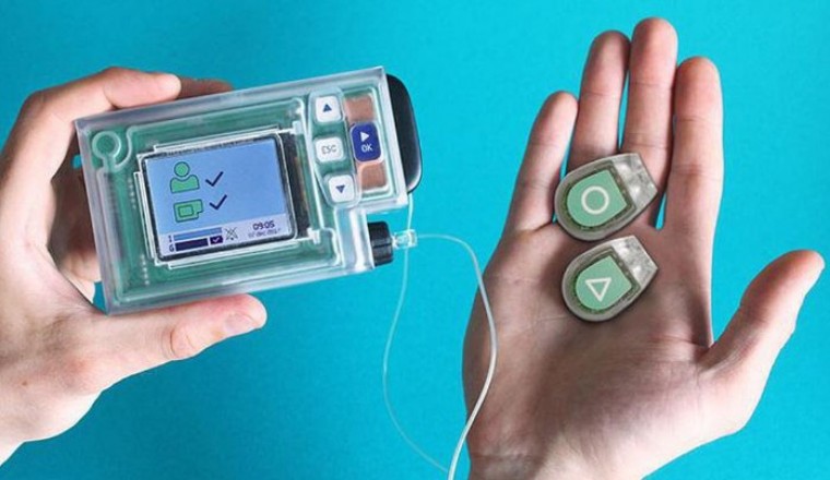 Sắp có tuyến tụy nhân tạo cho bệnh nhân tiểu đường