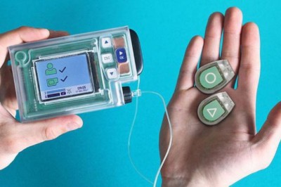 Sắp có tuyến tụy nhân tạo cho bệnh nhân tiểu đường