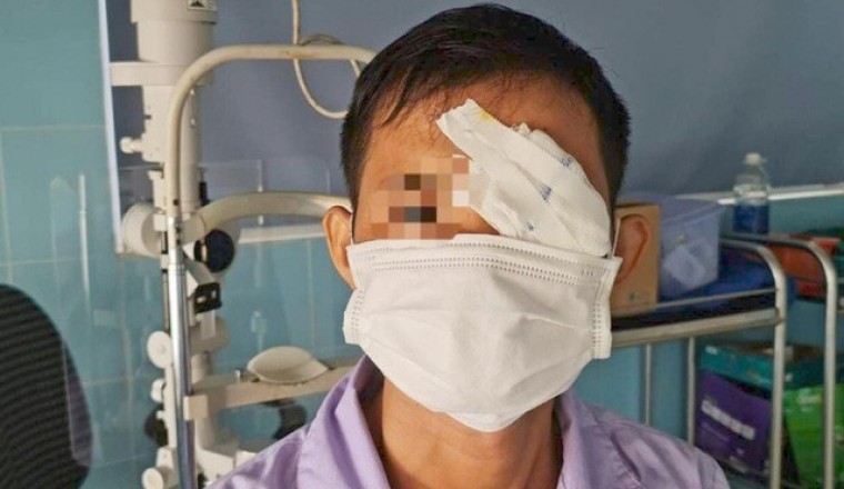 Mua cò về làm thịt một người đàn ông bị cò mổ thủng mắt