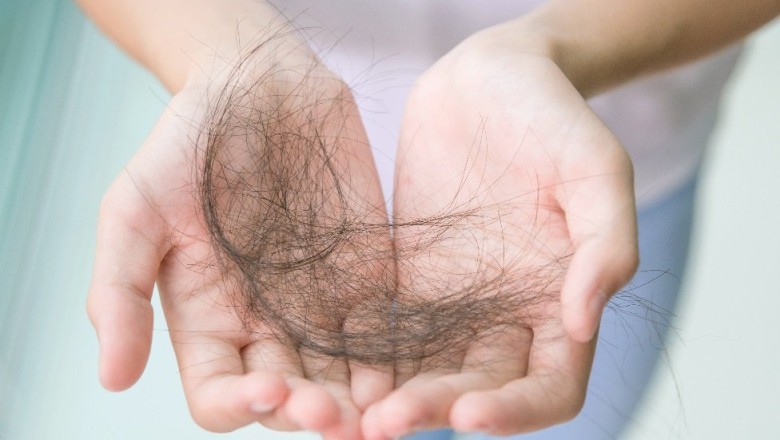 Rụng tóc, phát ban - di chứng Covid