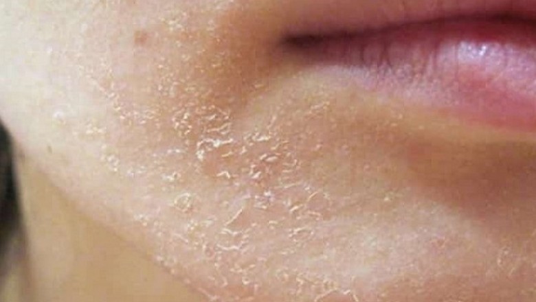 Có nên dùng sữa rửa mặt vào buổi sáng?