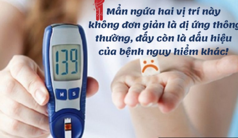 2 vị trí ngứa ngáy là dấu hiệu đường huyết tăng cao, bệnh tiểu đường rình rập: Tuyệt đối đừng chủ quan!