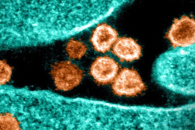 Bác sĩ Việt tại Mỹ: Biến thể Omicron nguy hiểm như thế nào?