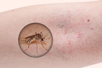 Lào lo ngại bùng phát dịch sốt xuất huyết