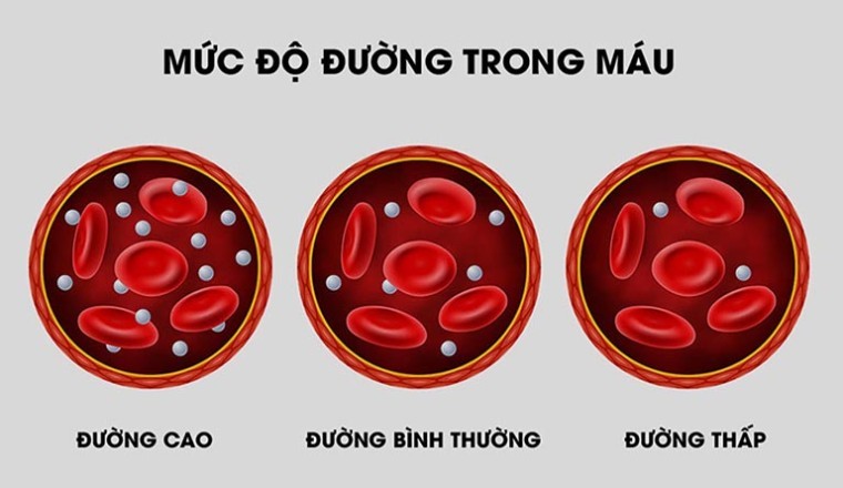 Những loại trà là đồ uống giúp kiểm soát lượng đường trong máu và giảm kháng insulin