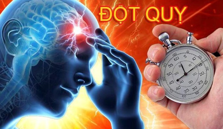 Đột quỵ là gì?
