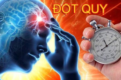 Đột quỵ là gì?