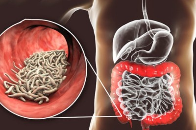 12 bài thuốc đông y, bài thuốc nam điều trị kiết lỵ cho trẻ em