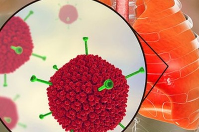 Virus Adeno mà nhiều trẻ đang nhiễm phải nguy hiểm ra sao?