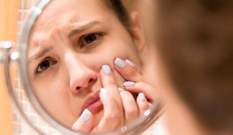 Nguyên nhân da tiết nhiều dầu và cách khắc phục