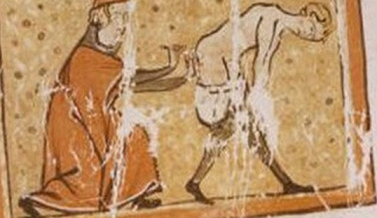 Thời cổ xưa con người từng dùng đỉa, than nóng để chữa bệnh trĩ