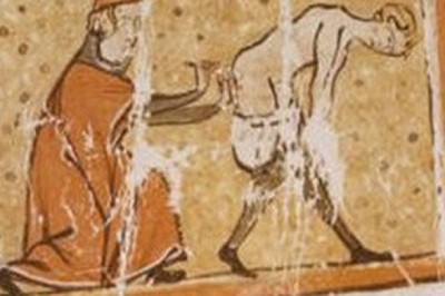 Thời cổ xưa con người từng dùng đỉa, than nóng để chữa bệnh trĩ