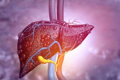 Phát triển thuốc mới điều trị gan nhiễm mỡ